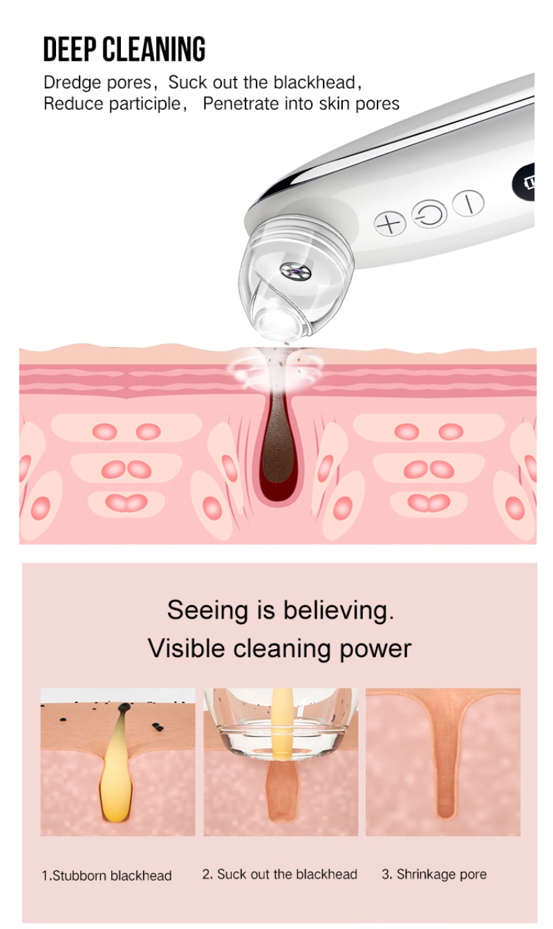 Electric Visual Blackhead Apparatus WiFi HD Camera Vacuum Suction Facial Care - Bild 4